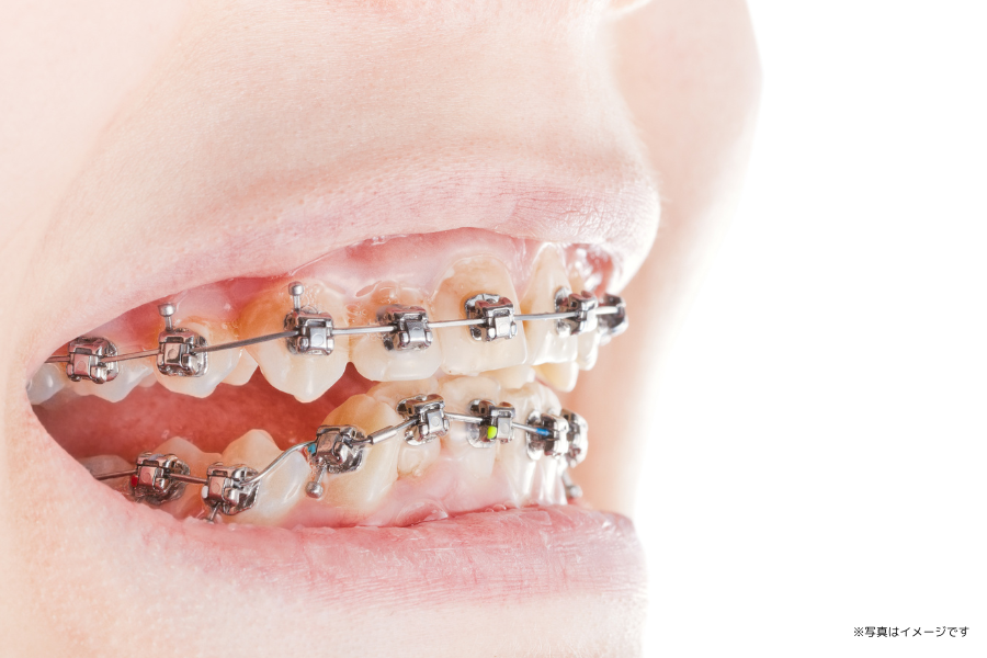 できるだけ歯を抜かず、痛みや費用への配慮も意識した診療方針が取られています