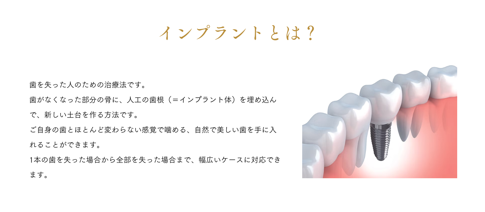 失った歯を補う治療法として、自然な見た目と噛み心地を取り戻すことができます