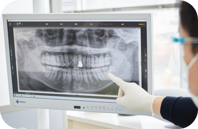 患者様の負担を軽減し、自然な歯をできるだけ長く維持することを目指しています