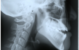 矯正専門の豊富な経験と丁寧な診療が支持される理由