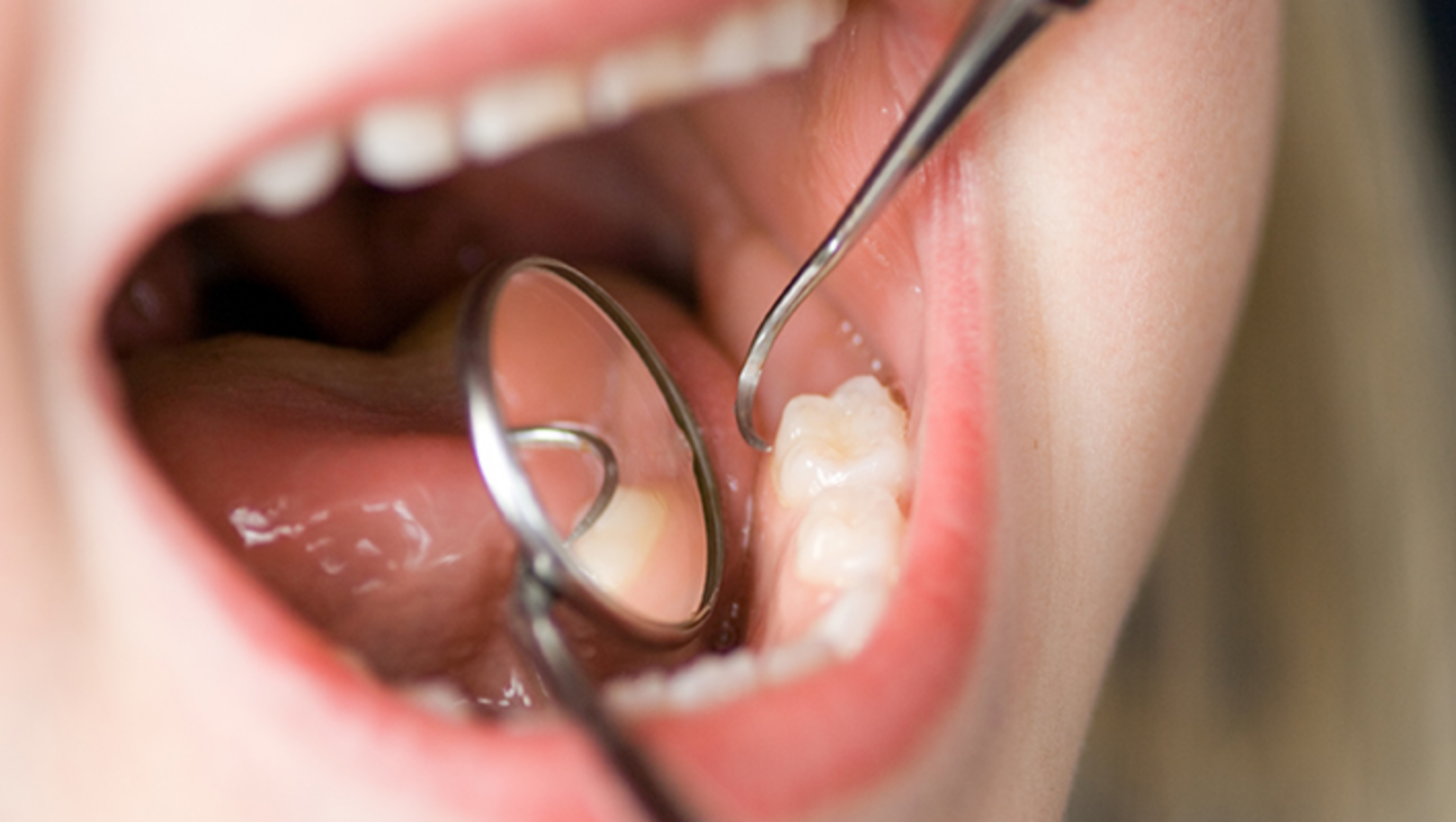 食事や睡眠といった生活習慣も虫歯・歯周病などのリスクと深く関わっています