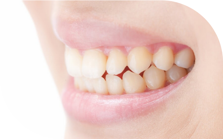 顎関節症はマウスピースで症状の緩和する場合もあります