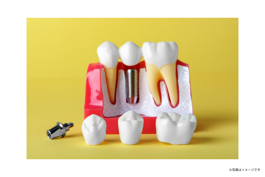 事前の綿密な診査と診断に基づき適切な処置を行っています