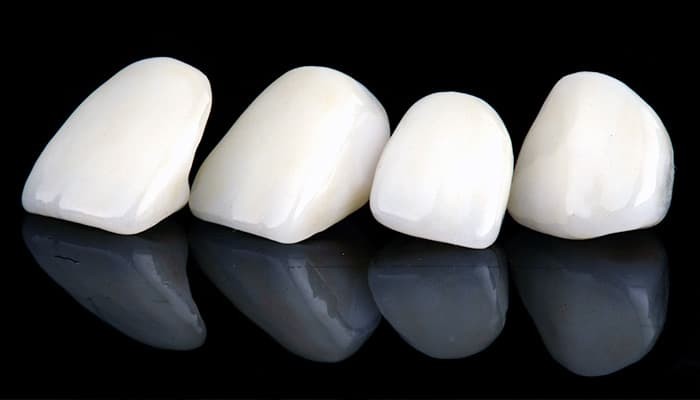 金属アレルギーの方でも安心です