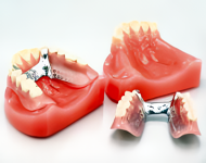 こだわりの入れ歯を製作します