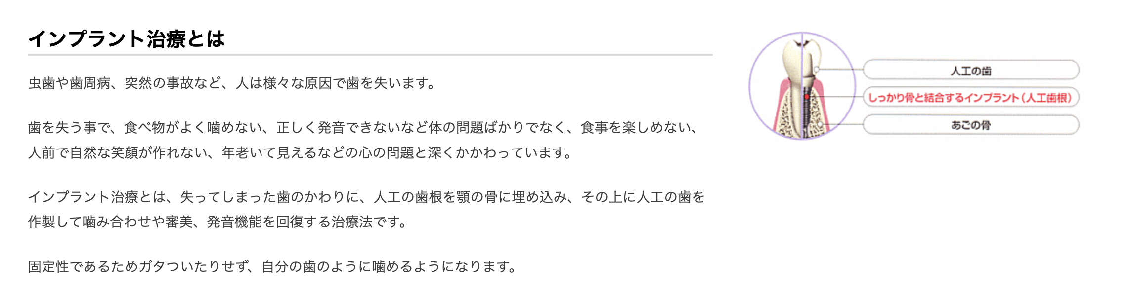 インプラント治療を通じて患者様の機能回復だけでなく、快適で自然な生活をサポートしています