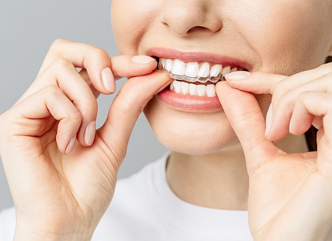 光学スキャナーを用いて精密な治療計画を立案しています