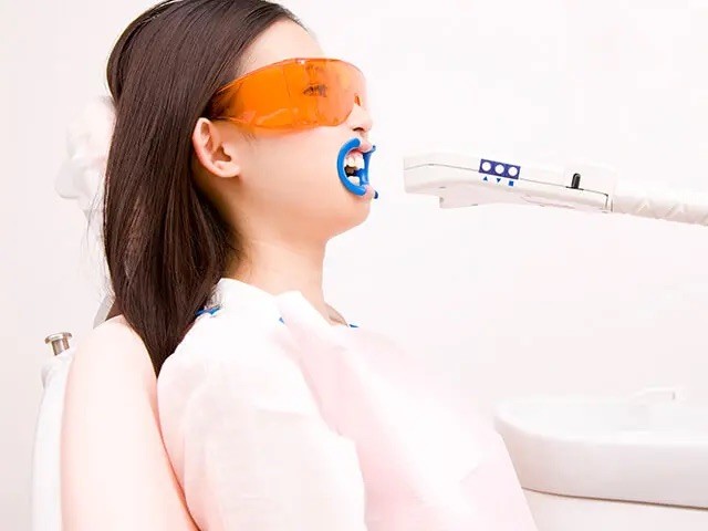 最適なホワイトニング方法をご提案