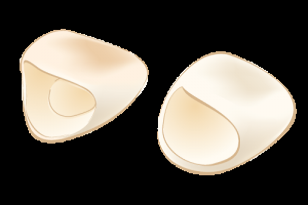 セラミックでできた修復物