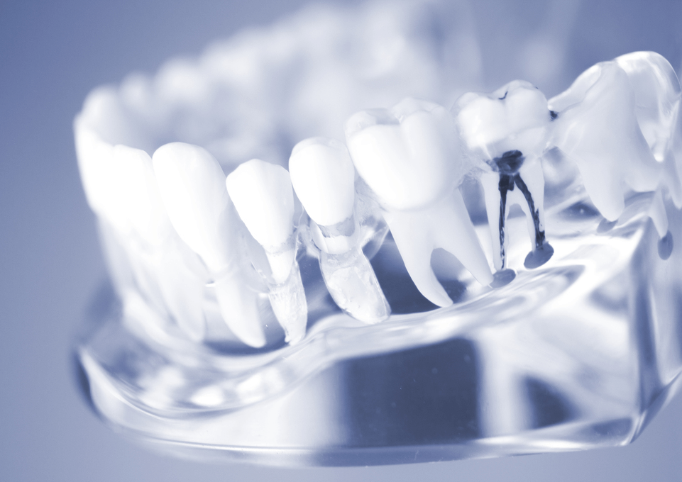 根管治療を提供