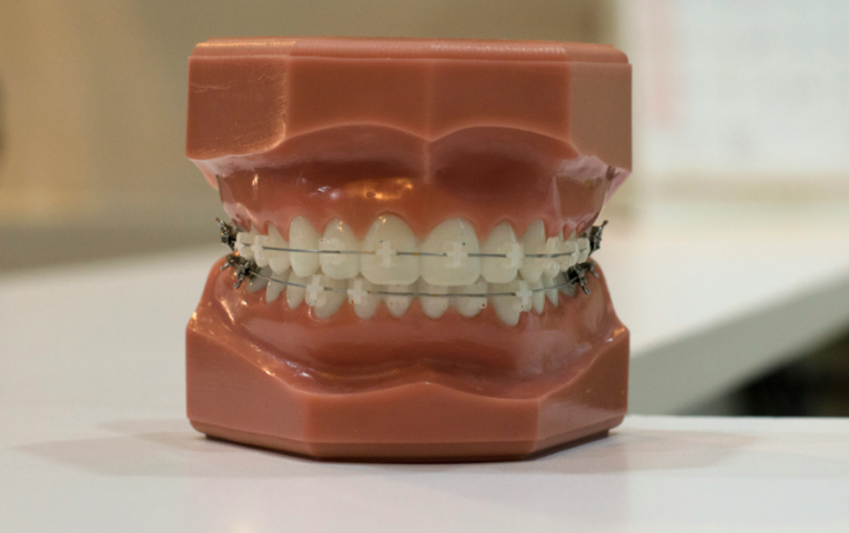 年齢を問わず対応する矯正診療の魅力