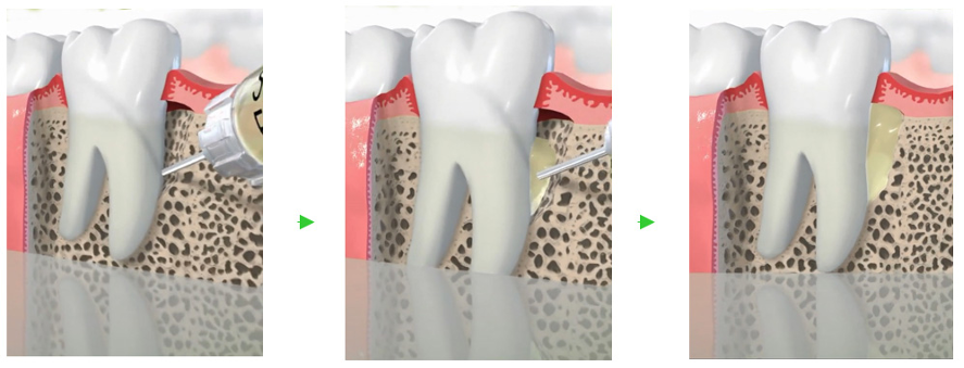 健康な口腔環境を保つための継続的なケア体制が整えられています