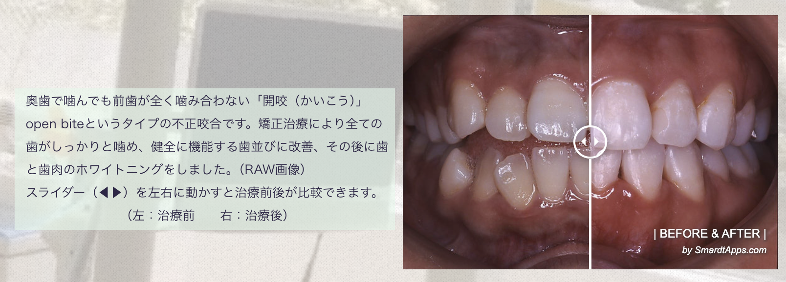 日本矯正歯科学会認定医による矯正治療を行っており、幅広い年齢層の患者様に対応しています