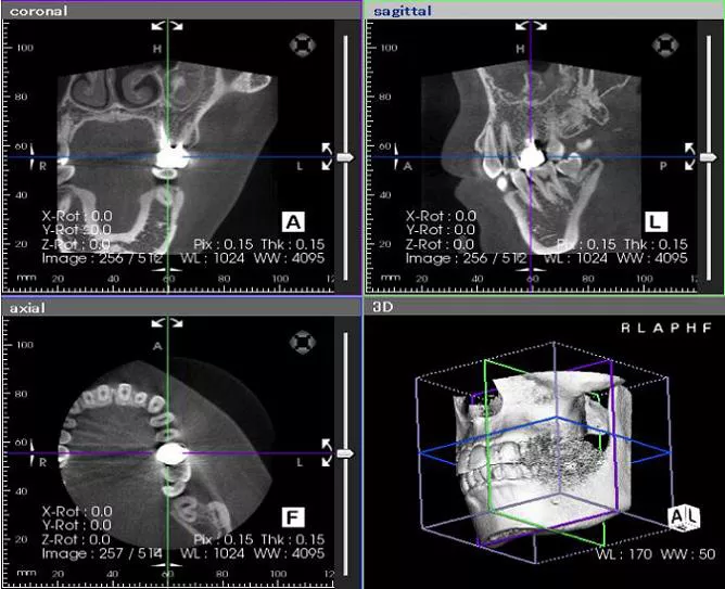 検査×深部治療×メンテナンスで叶える長期安定の口腔環境