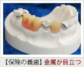 ニーズ合わせた義歯を作製