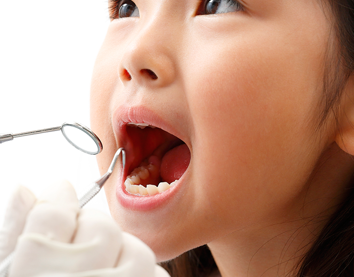 お子様の達成感を大切にする小児歯科