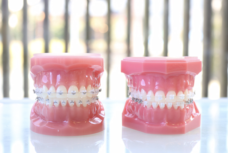 患者様の年齢やお悩みに応じて、それぞれに適した方法をご提案しています