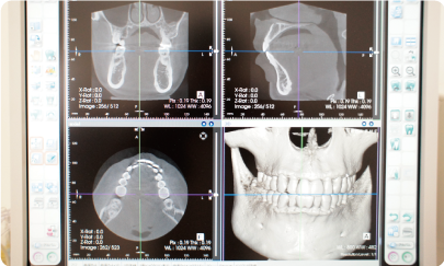 見た目・快適さ・機能性を追求した入れ歯づくり
