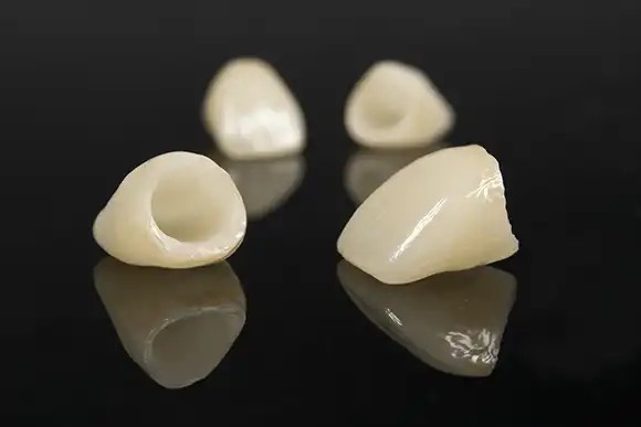 見た目だけでなくしっかり噛める歯を目指した治療を提供しています