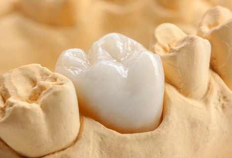 写真はイメージです