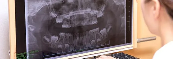 最新設備を用いた安全なインプラント治療を行っています