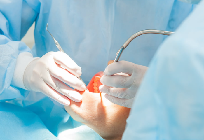 専門的な技術で支えるインプラント治療