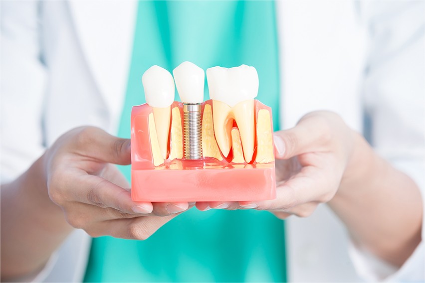 大学病院と同じインプラント治療を提供