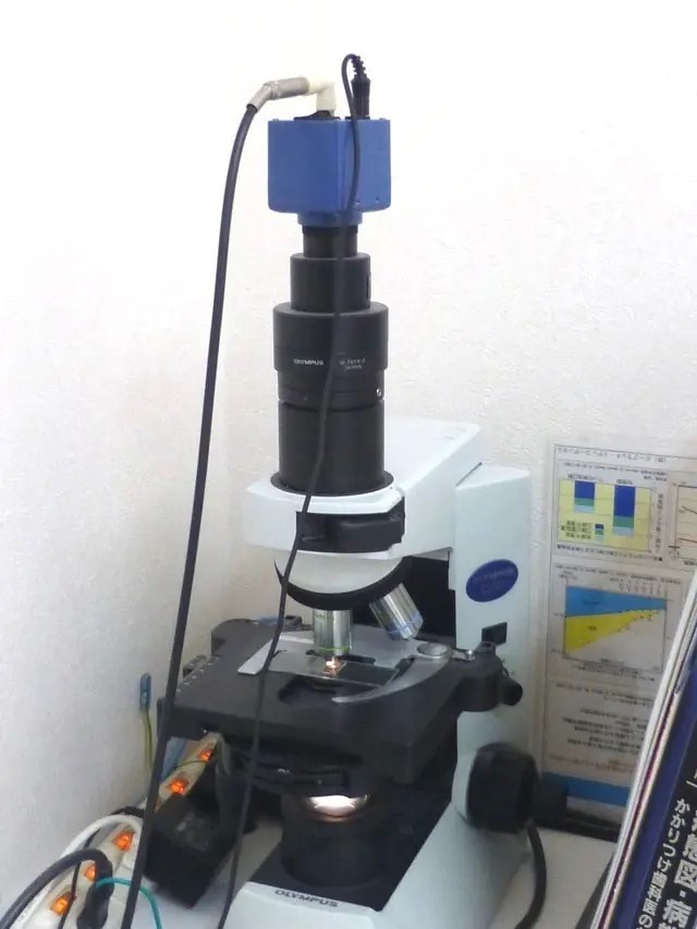 歯周病菌の原因を検査する位相差顕微鏡です