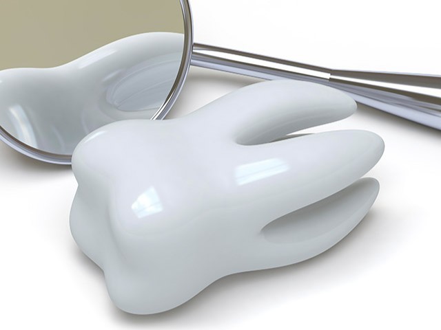 インプラントは第二の永久歯と呼ばれています