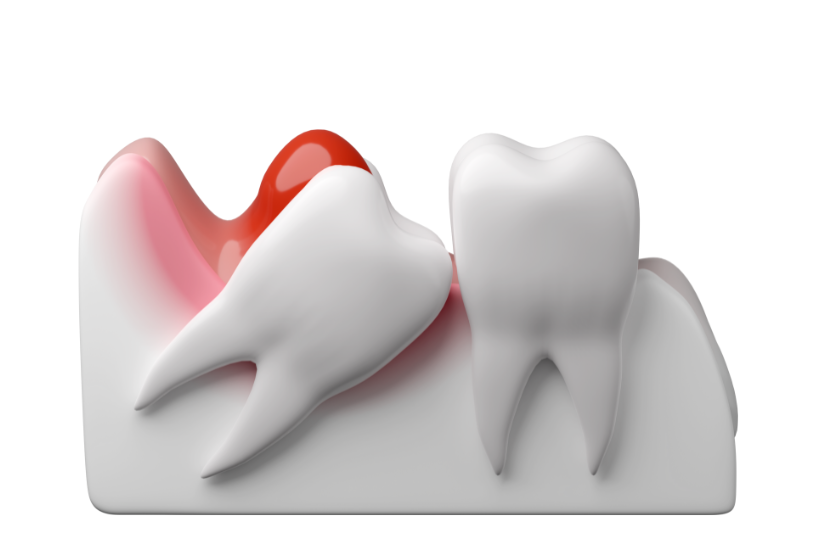 まごころ歯科の親知らず治療は、患者様の安心と安全を最優先に考えて行われます。