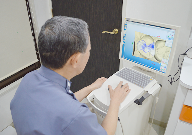 セレックを活用した補綴物を提供