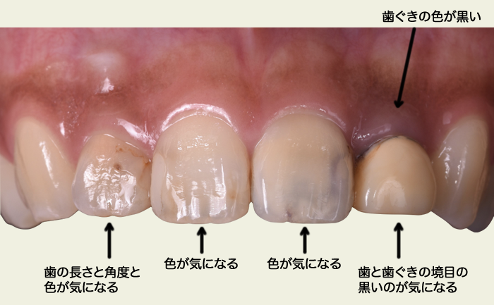 歯に関するさまざまなお悩みを解決します