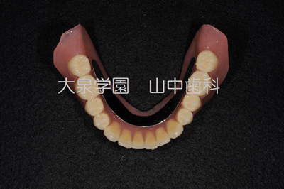 一人ひとりに合った入れ歯を製作