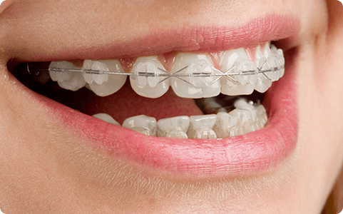 専門医による確かな矯正を提供いたします