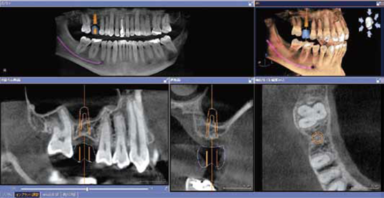 【氏家駅 西口 車で11分・駐車場完備】精密で痛みに配慮した診療を行う名取歯科クリニック