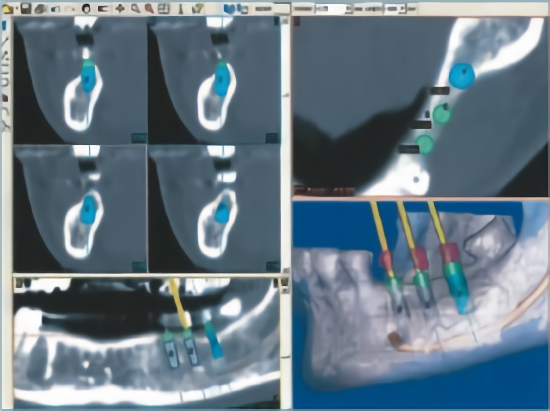 CT検査で安全で無理のない治療を