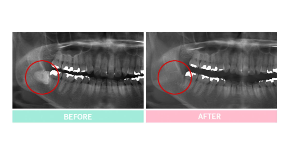 親知らずの抜歯や顎関節症、口腔粘膜の異常、外傷など、さまざまな症例に対応します
