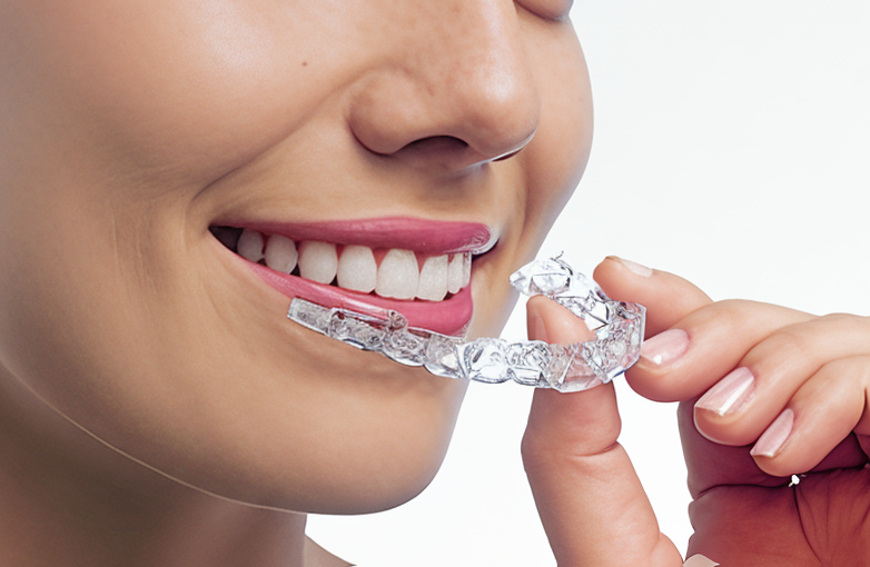 日本矯正歯科学会認定医による見えない矯正で自然な笑顔を実現