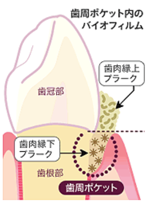 ホームケアとプロフェッショナルケアはどちらも大切です。