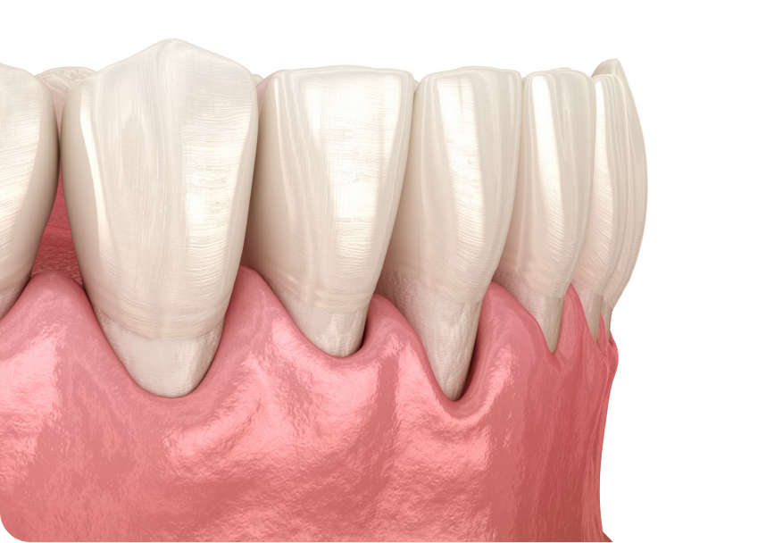 歯周病の予防や治療のために気になる症状が出たら早めの受診をして下さい