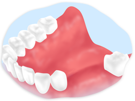 歯が抜けてしまったらすぐにご相談ください