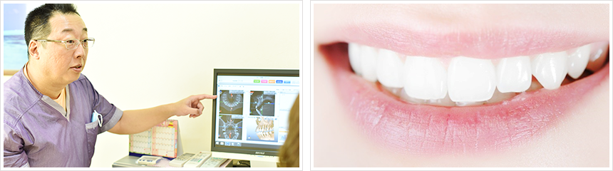 患者様一人ひとりのニーズに合わせて入れ歯治療を提供しています