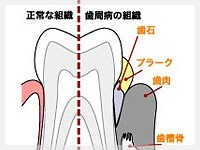 歯と歯茎の両方が健康であってこそ真の口腔の健康が実現できるという考えのもと、歯周病治療に力を入れています