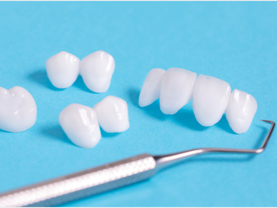 歯の機能回復と見た目の美しさ