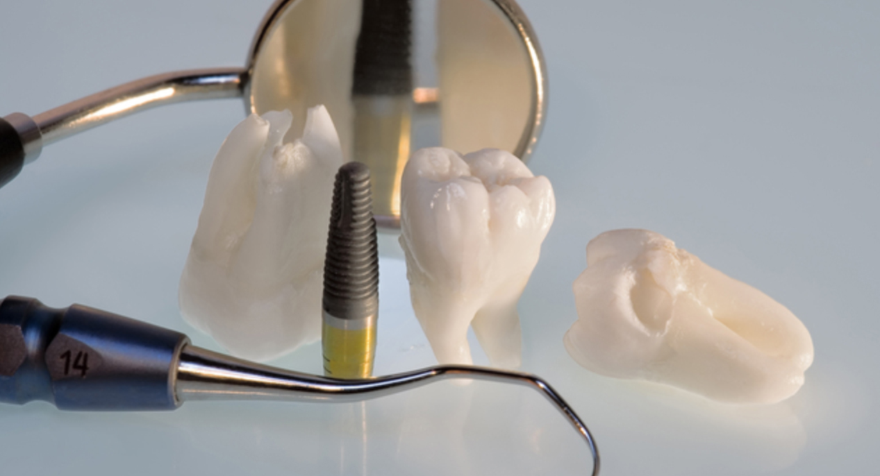 失った歯でお悩みの方や、口元に自信を持ちたい方は、ぜひらいおん歯科クリニック サクラス戸塚院のインプラント治療をご検討ください。