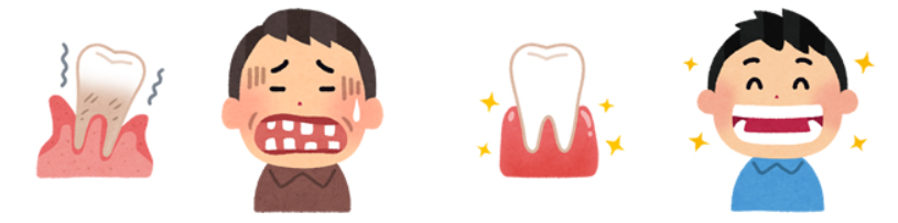 初期から重度の歯周病でも治療可能です