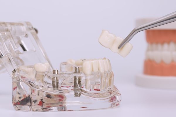 ※画像はイメージです