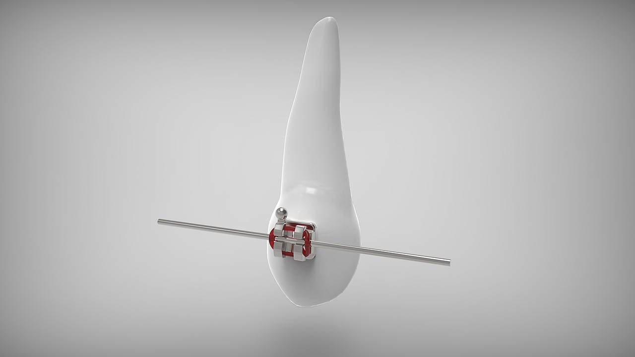 患者様一人ひとりの理想やお悩みに寄り添い、安心して続けられる矯正治療を通じて、自然で美しい口元へと導いています。※写真はイメージです。