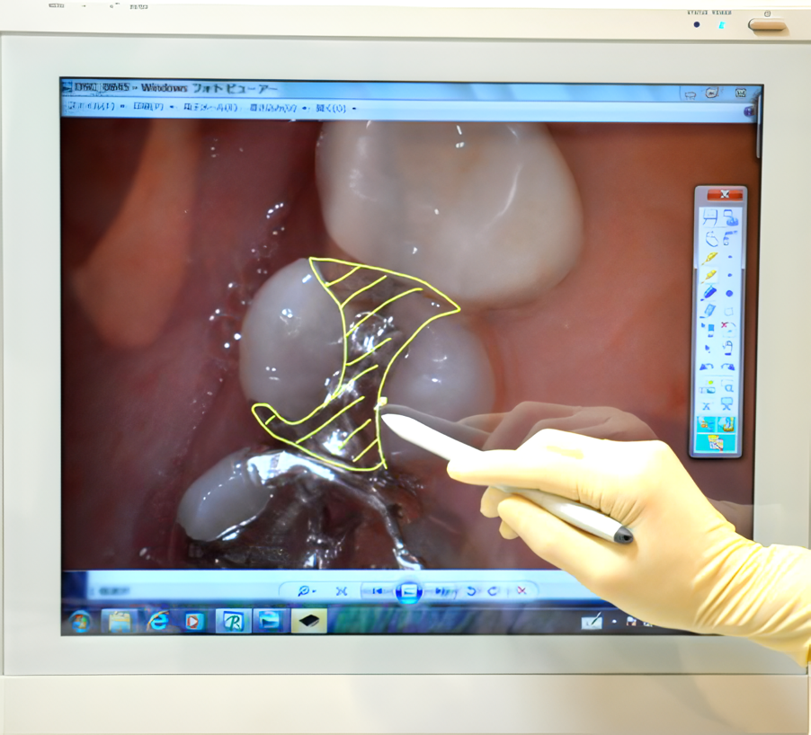 【越谷駅 西口より車で7分】【平日20時まで診療】歯を削らない全身視点の岩佐歯科医院
