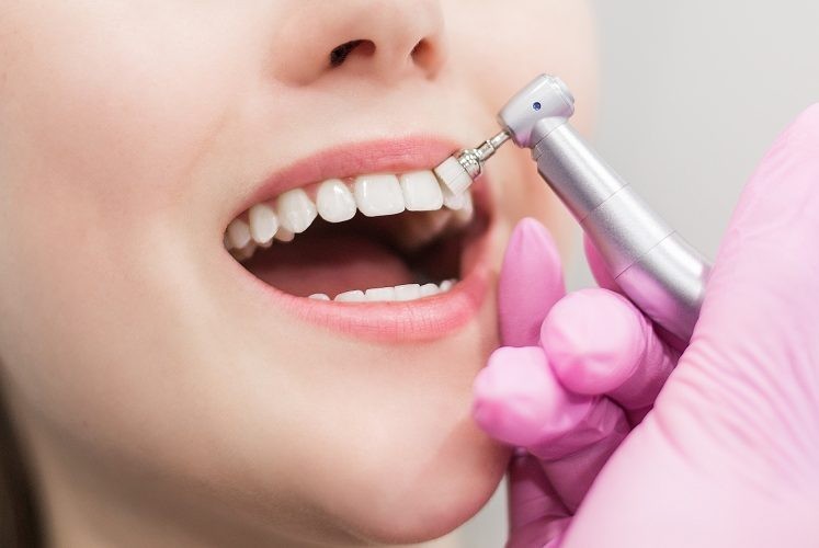 治療後の良好な口腔環境を維持するためにも定期検診を推奨しています